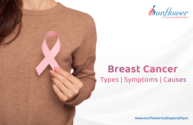 Breast Cancer: Types, Symptoms, and Causes