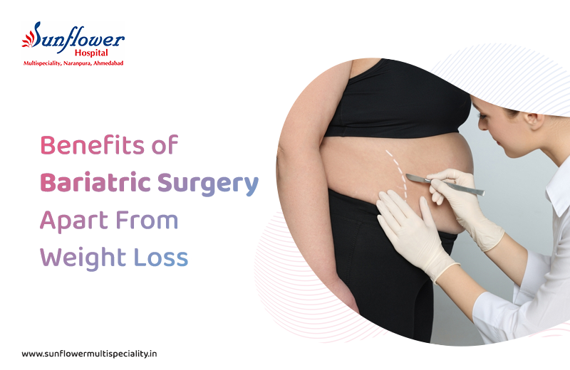 What are the Benefits of Bariatric Surgery Apart from Weight Loss?