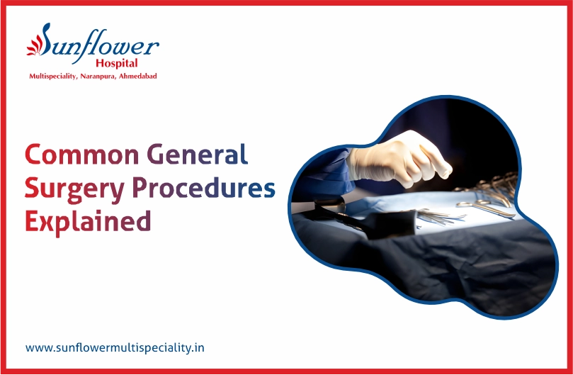Common General Surgery Procedures Explained